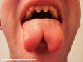 Forked-tongue